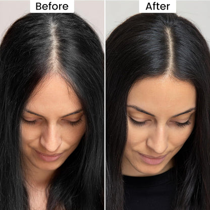 Root Touch up Powder, Instant Hairline Powder for Thinning Areas and Gray Hair Coverage, Natural and Non-greasy Root Cover up for Women and Men