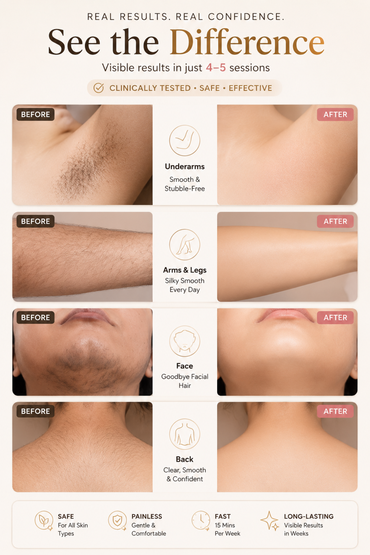 Graceful Glow Professional IPL Pro|10LAKH Flashes ✨